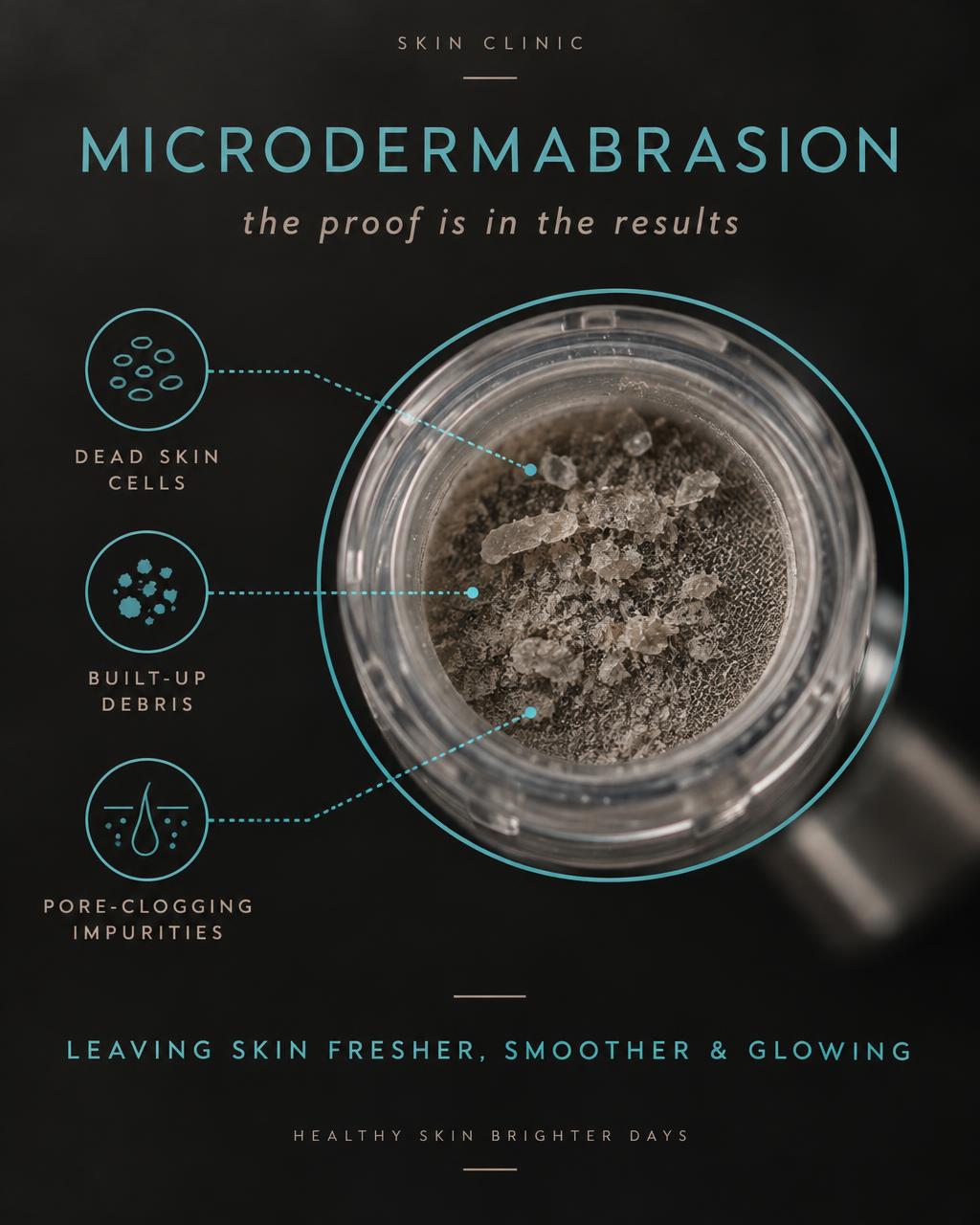 What microdermabrasion lifts away